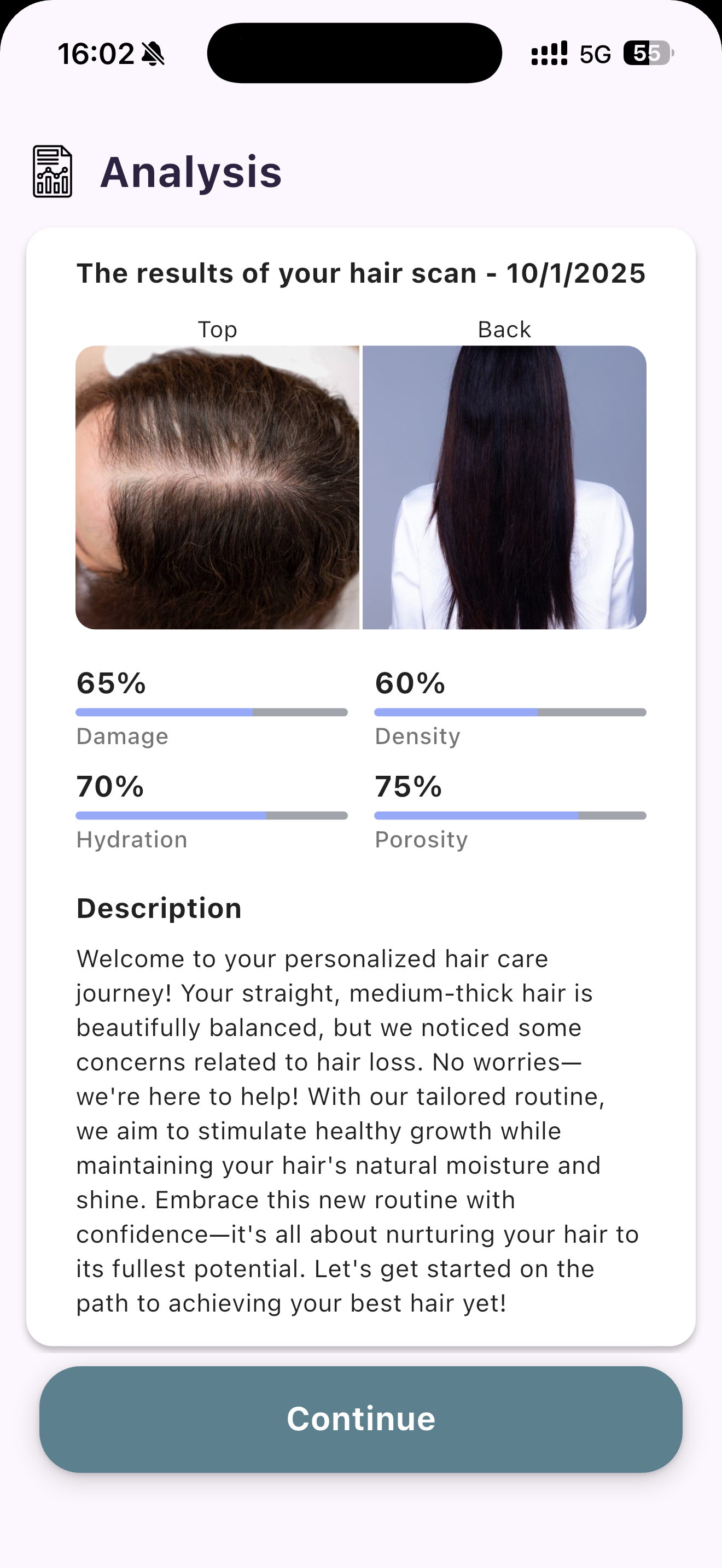 Hair AI Analysis Results - AI-Powered Scan Complete
